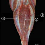 calf strain running